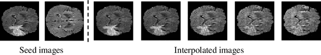 Figure 3 for GLOWin: A Flow-based Invertible Generative Framework for Learning Disentangled Feature Representations in Medical Images