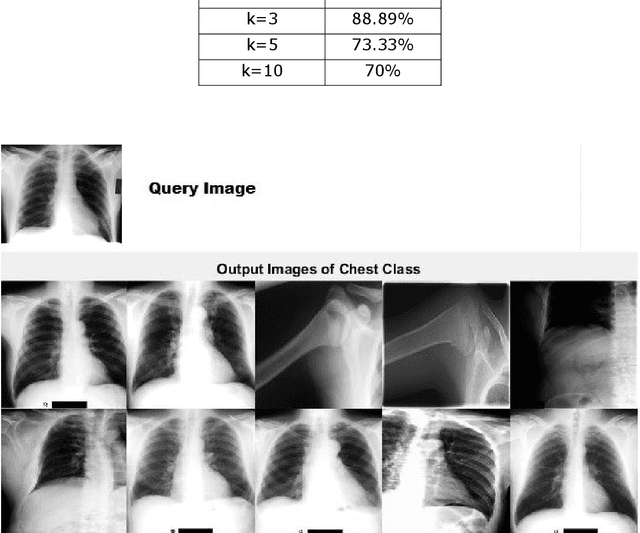 Figure 3 for A Bag of Visual Words Model for Medical Image Retrieval