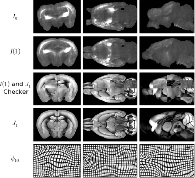 Figure 2 for A Large Deformation Diffeomorphic Approach to Registration of CLARITY Images via Mutual Information