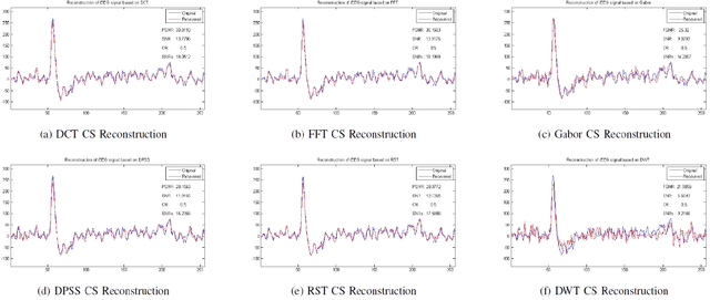 Figure 3 for Study on Compressed Sensing of Action Potential