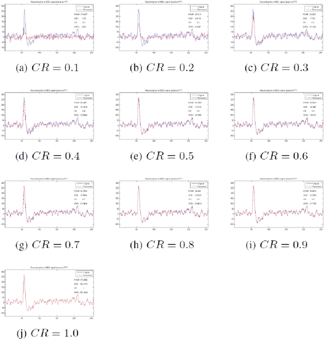 Figure 4 for Study on Compressed Sensing of Action Potential