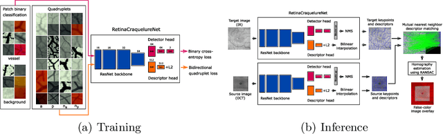 Figure 1 for A Keypoint Detection and Description Network Based on the Vessel Structure for Multi-Modal Retinal Image Registration