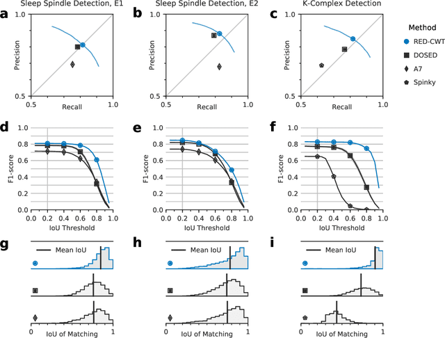 Figure 3 for RED: Deep Recurrent Neural Networks for Sleep EEG Event Detection