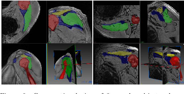 Figure 3 for Active Learning for Segmentation Based on Bayesian Sample Queries