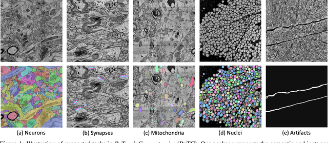 Figure 1 for PyTorch Connectomics: A Scalable and Flexible Segmentation Framework for EM Connectomics
