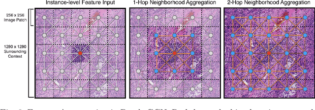 Figure 4 for Whole Slide Images are 2D Point Clouds: Context-Aware Survival Prediction using Patch-based Graph Convolutional Networks
