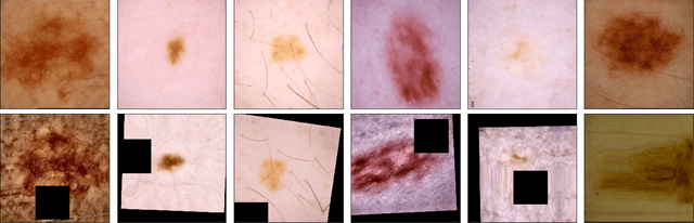 Figure 3 for Identifying Melanoma Images using EfficientNet Ensemble: Winning Solution to the SIIM-ISIC Melanoma Classification Challenge