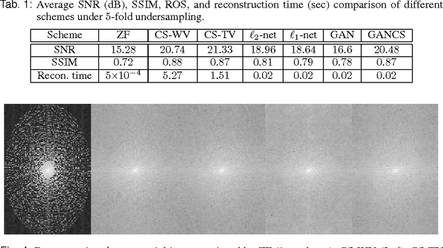 Figure 4 for Deep Generative Adversarial Networks for Compressed Sensing Automates MRI