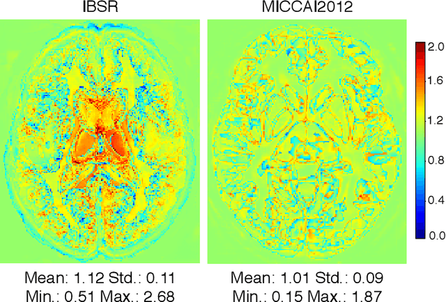 Figure 3 for Atlas-aware ConvNetfor Accurate yet Robust Anatomical Segmentation
