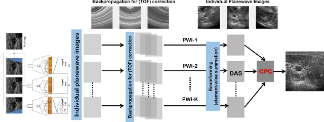 Figure 1 for Phase Aberration Robust Beamformer for Planewave US Using Self-Supervised Learning