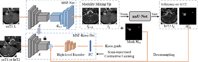 Figure 1 for Unsupervised Cross-Modality Domain Adaptation for Vestibular Schwannoma Segmentation and Koos Grade Prediction based on Semi-Supervised Contrastive Learning