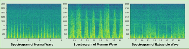 Figure 3 for A Visual Domain Transfer Learning Approach for Heartbeat Sound Classification