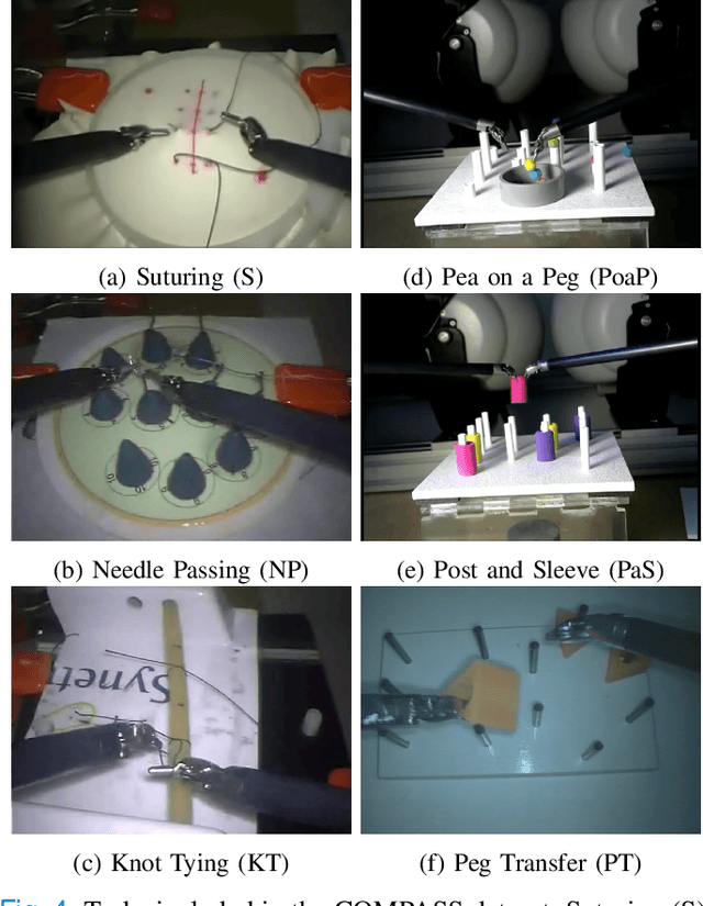 Figure 4 for COMPASS: A Formal Framework and Aggregate Dataset for Generalized Surgical Procedure Modeling