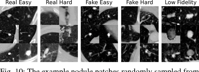 Figure 2 for Decompose to manipulate: Manipulable Object Synthesis in 3D Medical Images with Structured Image Decomposition