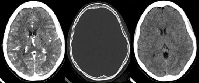 Figure 1 for Improved ICH classification using task-dependent learning
