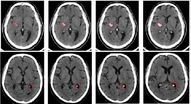 Figure 3 for Improved ICH classification using task-dependent learning