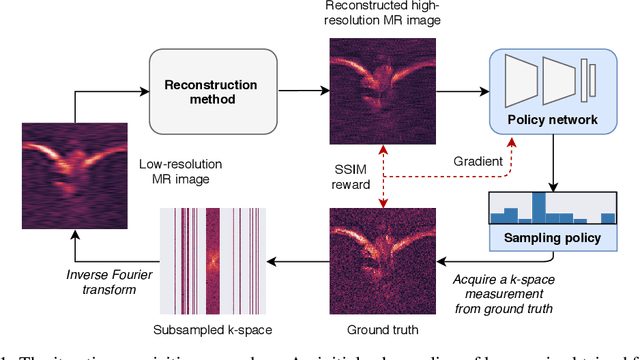 Figure 1 for Experimental design for MRI by greedy policy search