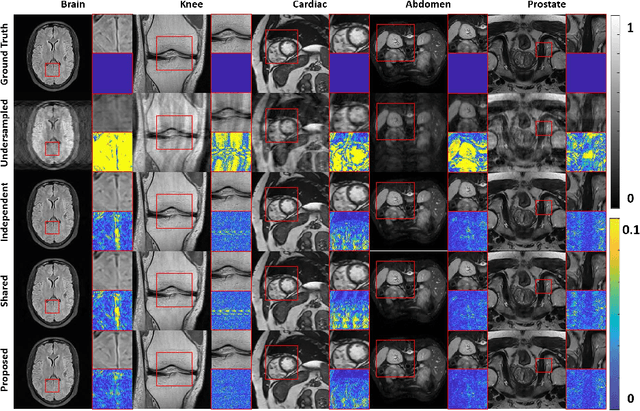 Figure 3 for Universal Undersampled MRI Reconstruction
