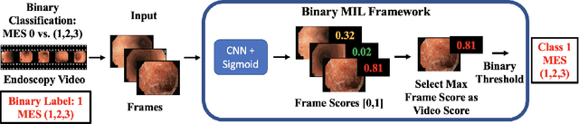 Figure 3 for Automatic Estimation of Ulcerative Colitis Severity from Endoscopy Videos using Ordinal Multi-Instance Learning