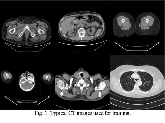 Figure 1 for Low-dose CT denoising with convolutional neural network