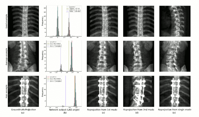Figure 2 for Representing Ambiguity in Registration Problems with Conditional Invertible Neural Networks