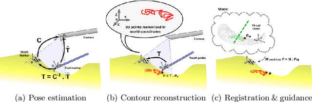 Figure 2 for Video-based computer aided arthroscopy for patient specific reconstruction of the Anterior Cruciate Ligament