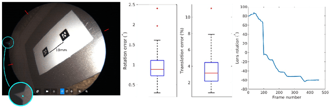 Figure 4 for Video-based computer aided arthroscopy for patient specific reconstruction of the Anterior Cruciate Ligament