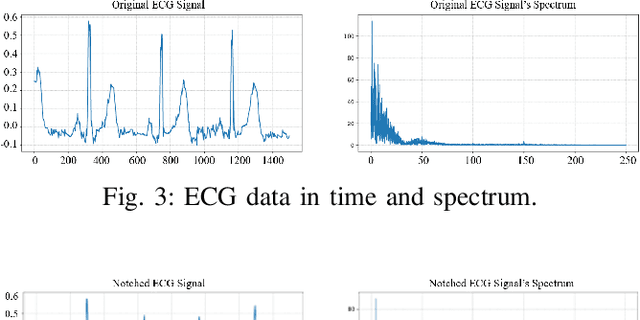 Figure 3 for Optimal Transport based Data Augmentation for Heart Disease Diagnosis and Prediction