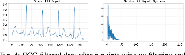 Figure 4 for Optimal Transport based Data Augmentation for Heart Disease Diagnosis and Prediction