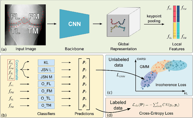 Figure 4 for Coherence Learning using Keypoint-based Pooling Network for Accurately Assessing Radiographic Knee Osteoarthritis