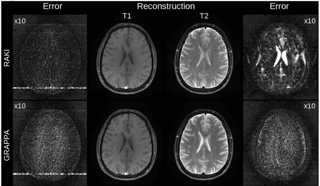 Figure 4 for Iterative RAKI with Complex-Valued Convolution for Improved Image Reconstruction with Limited Scan-Specific Training Samples