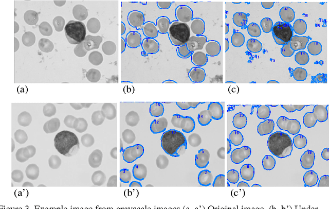 Figure 3 for A Novel Image Segmentation Enhancement Technique based on Active Contour and Topological Alignments