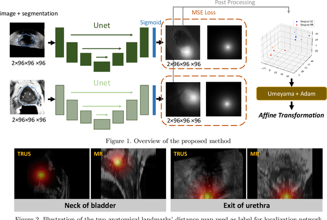 Figure 1 for Distance Map Supervised Landmark Localization for MR-TRUS Registration