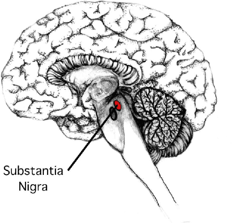 Figure 1 for An Explainable Machine Learning Model for Early Detection of Parkinson's Disease using LIME on DaTscan Imagery
