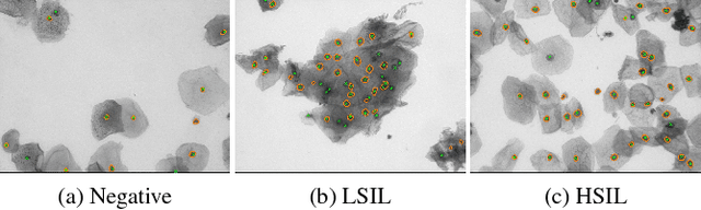 Figure 4 for A New Cervical Cytology Dataset for Nucleus Detection and Image Classification and Methods for Cervical Nucleus Detection