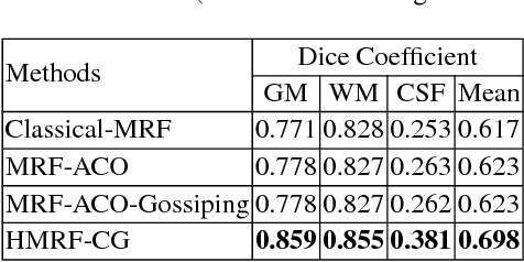 Figure 4 for Combination of Hidden Markov Random Field and Conjugate Gradient for Brain Image Segmentation