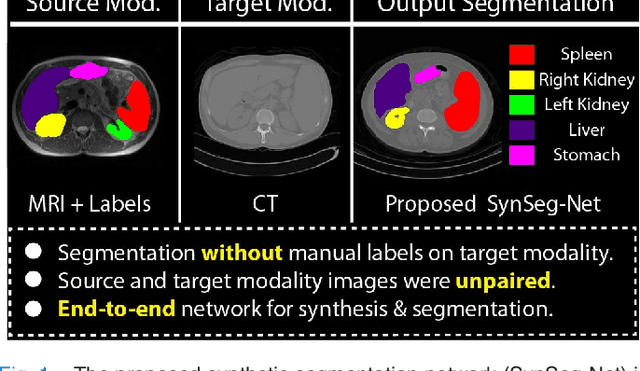 Figure 1 for SynSeg-Net: Synthetic Segmentation Without Target Modality Ground Truth