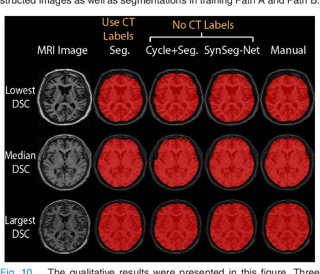 Figure 2 for SynSeg-Net: Synthetic Segmentation Without Target Modality Ground Truth