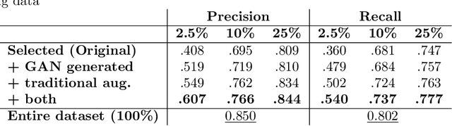 Figure 4 for Lesion Conditional Image Generation for Improved Segmentation of Intracranial Hemorrhage from CT Images