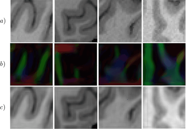 Figure 4 for Manifold-Aware CycleGAN for High Resolution Structural-to-DTI Synthesis
