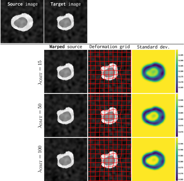 Figure 3 for Metric Learning for Image Registration