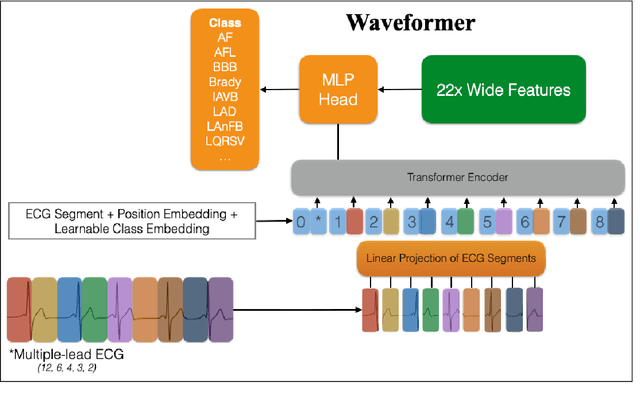 Figure 1 for Convolution-Free Waveform Transformers for Multi-Lead ECG Classification
