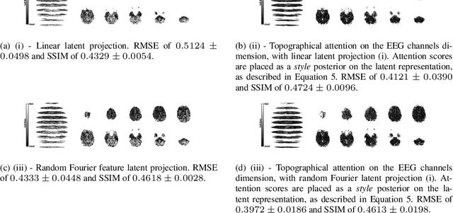 Figure 3 for EEG to fMRI Synthesis Benefits from Attentional Graphs of Electrode Relationships