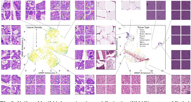 Figure 3 for Adversarial learning of cancer tissue representations