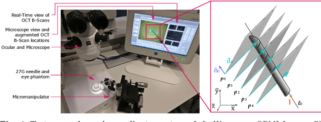Figure 1 for Fast 5DOF Needle Tracking in iOCT
