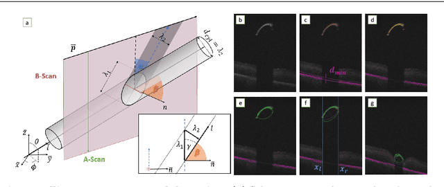 Figure 3 for Fast 5DOF Needle Tracking in iOCT