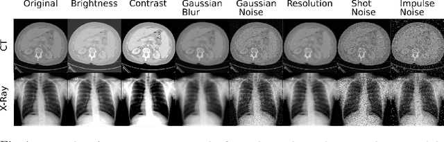 Figure 1 for Evaluating the Robustness of Self-Supervised Learning in Medical Imaging