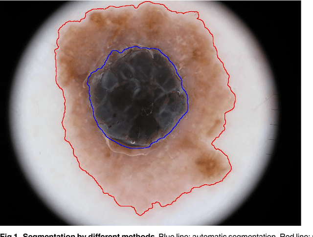 Figure 2 for Comparison of computer systems and ranking criteria for automatic melanoma detection in dermoscopic images