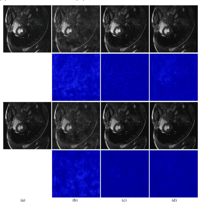 Figure 2 for Virtual Coil Augmentation Technology for MRI via Deep Learning