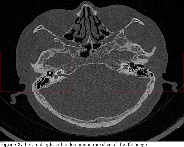 Figure 4 for Ricci Curvature Based Volumetric Segmentation of the Auditory Ossicles